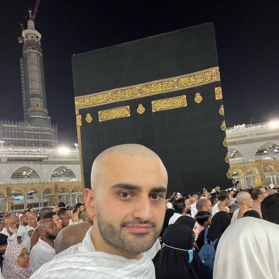 CZN Burak kanser mi? Aşırı zayıflaması korkutmuştu, şimdi de saçlarını kazıttı! 10